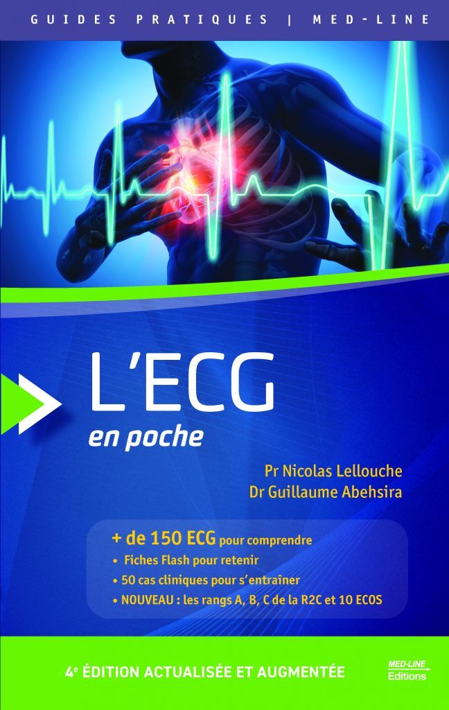 L'ECG EN POCHE R2C + DE 150 ECG - NICOLAS LELLOUCHE, GUILLAUME ABEHSIRA - MED LINE