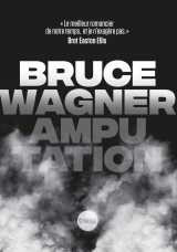 Amputation